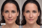 The Collagen Mask